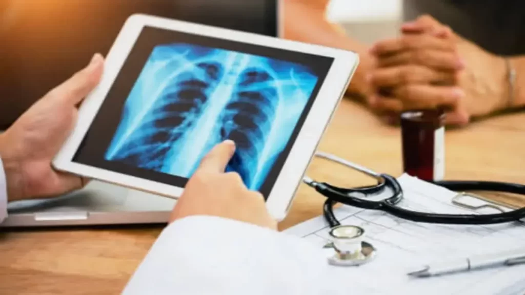 News on Health 29th June 2023 ArdorComm Media Group AI Algorithm with High Accuracy Boosts Lung Cancer Detection on Chest X-Rays, Study Finds