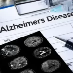 News on Health 18th July 2023 ArdorComm Media Group New Rating System Introduced for Alzheimer’s Diagnosis, Embracing Cancer-Like Staging