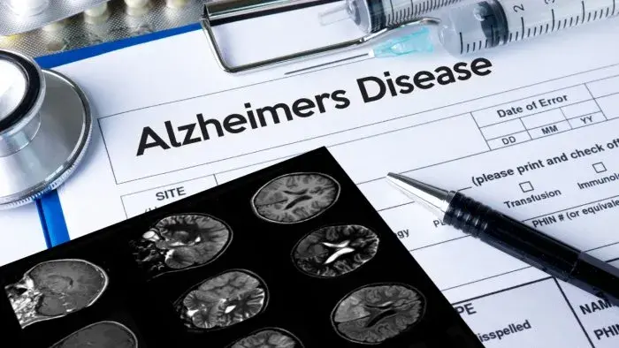 News on Health 18th July 2023 ArdorComm Media Group New Rating System Introduced for Alzheimer’s Diagnosis, Embracing Cancer-Like Staging