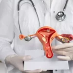 News on Health 8th Sept 2023 ArdorComm Media Group Novel HPV Methylation Test Boosts Cervical Cancer Detection